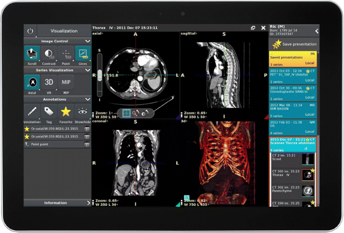 medical device software-development 1